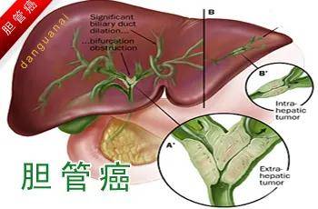 鄭大干細胞 免疫細胞存儲，讓生命多備一份戰斗武器